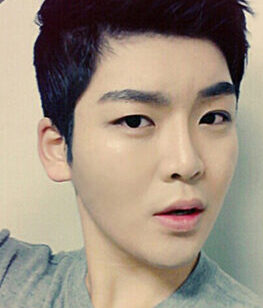 [Natural V line + cheekbone reduction + T.O.P rhinoplasty + combination buried + forehead fat grafting] Jiho Kim