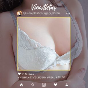 [Breast Augmentation (Motiva)] Lee Yujin | Plastic Surgery Korea