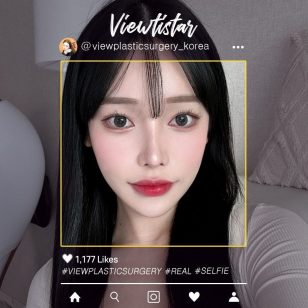 [Контурная пластика в 3точках + Блефаропластика + Ринопластика] Koo Dohui | Plastic Surgery Korea