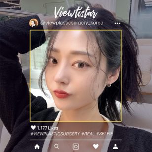 [Ринопластика + Перераспределение жира под глазами] Lee Hyeri | Plastic Surgery Korea