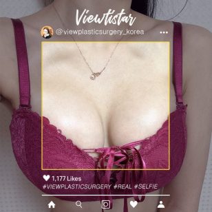 [Увеличение груди(Sebbin)] Lee Hyeri | Plastic Surgery Korea