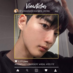 [Контурная пластика в 3точках + Блефаропластика] Park Jinwon | Plastic Surgery Korea