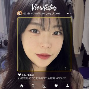 [Контурная пластика в 3точках+Перераспределение жира под глазами+Липофилинг] Lee Minji | Plastic Surgery Korea