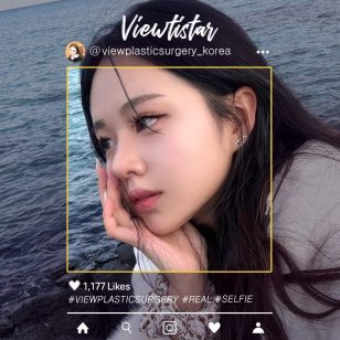 [Ринопластика] Lim Sohyeon | Plastic Surgery Korea