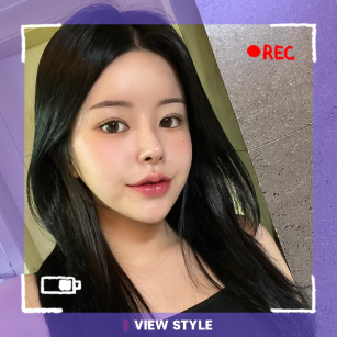 10 месяцев после моей пластической операции в Корее – Честный отзыв