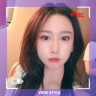 [Контурная пластика в 3точках / Ринопластика] До и после: контурная пластика лица (3 зоны) + ринопластика в клинике View Plastic Surgery, Корея